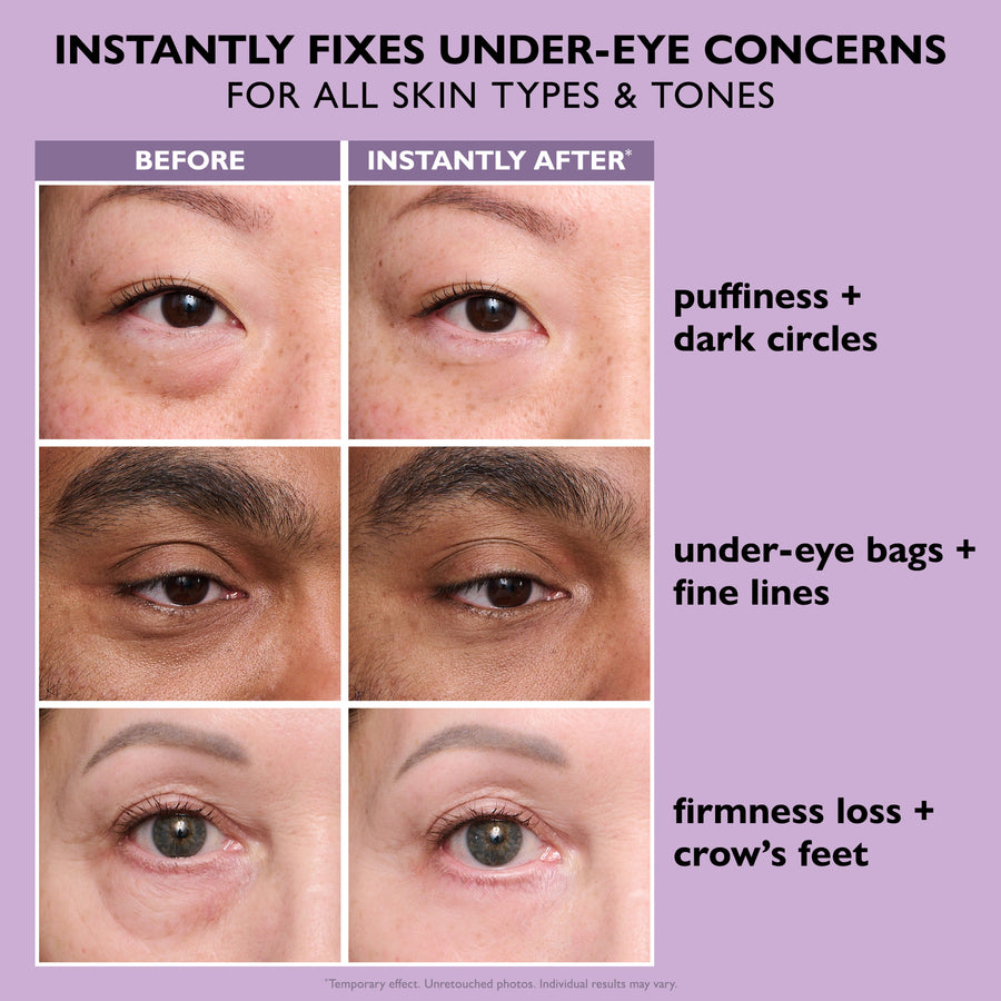 Last 3 Hours:🔥 Up to 60% OFF – Instant Eye Tightener Easy-Wear Formula