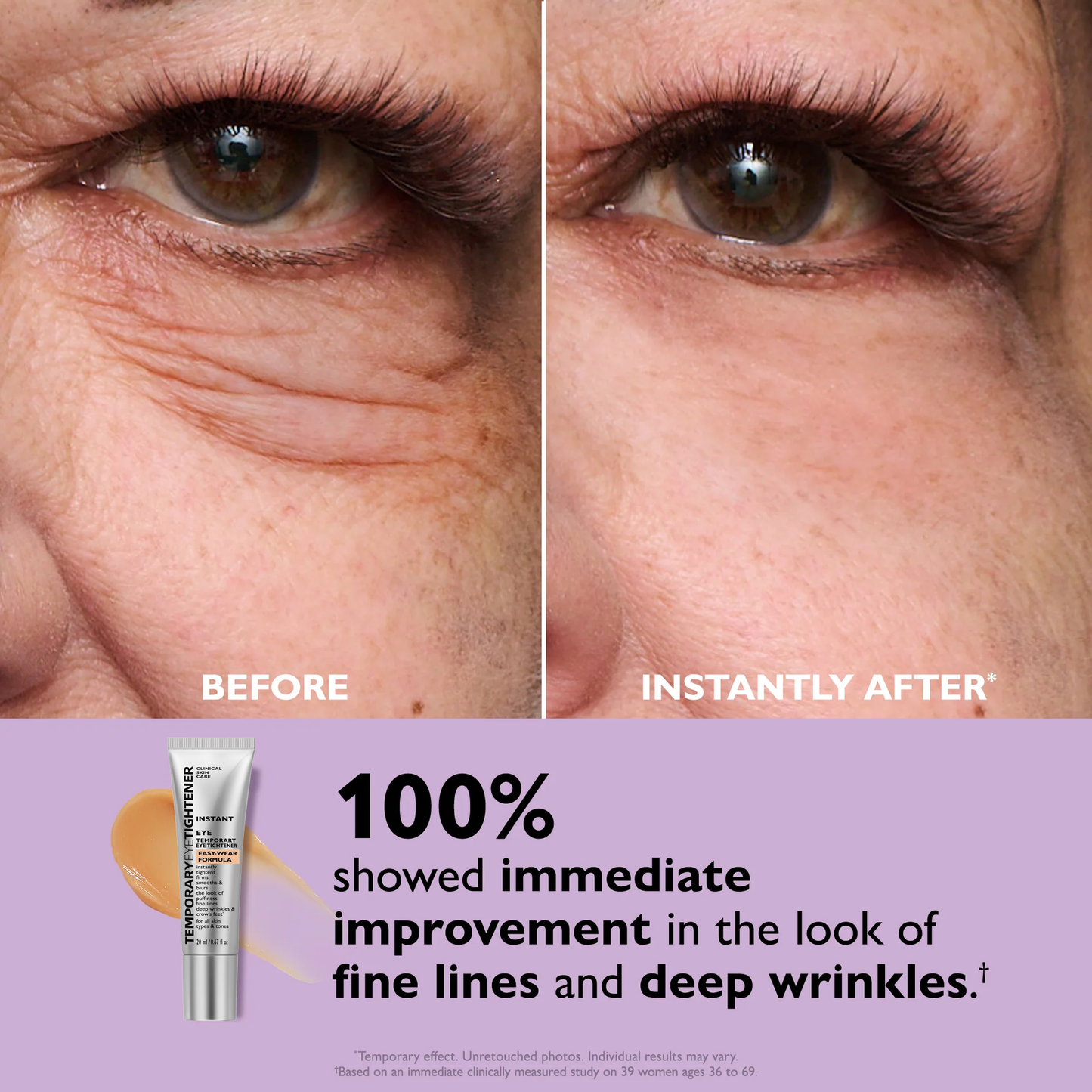 Last 3 Hours:🔥 Up to 60% OFF – Instant Eye Tightener Easy-Wear Formula