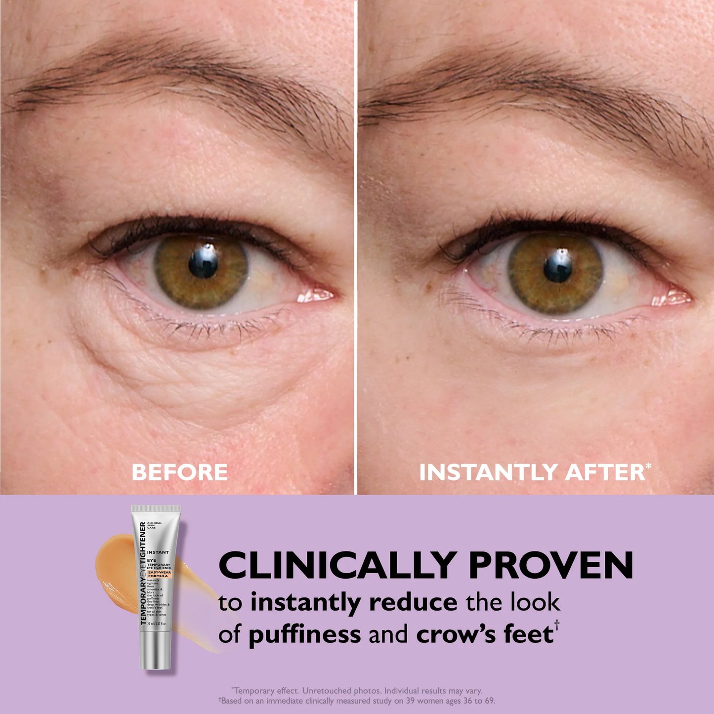 Last 3 Hours:🔥 Up to 60% OFF – Instant Eye Tightener Easy-Wear Formula