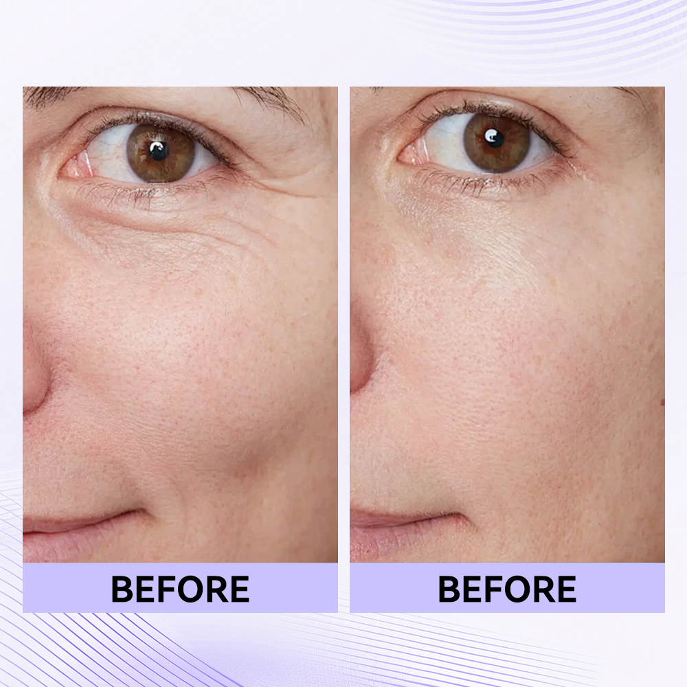 Last 3 Hours:🔥 Up to 60% OFF – Instant Eye Tightener Easy-Wear Formula