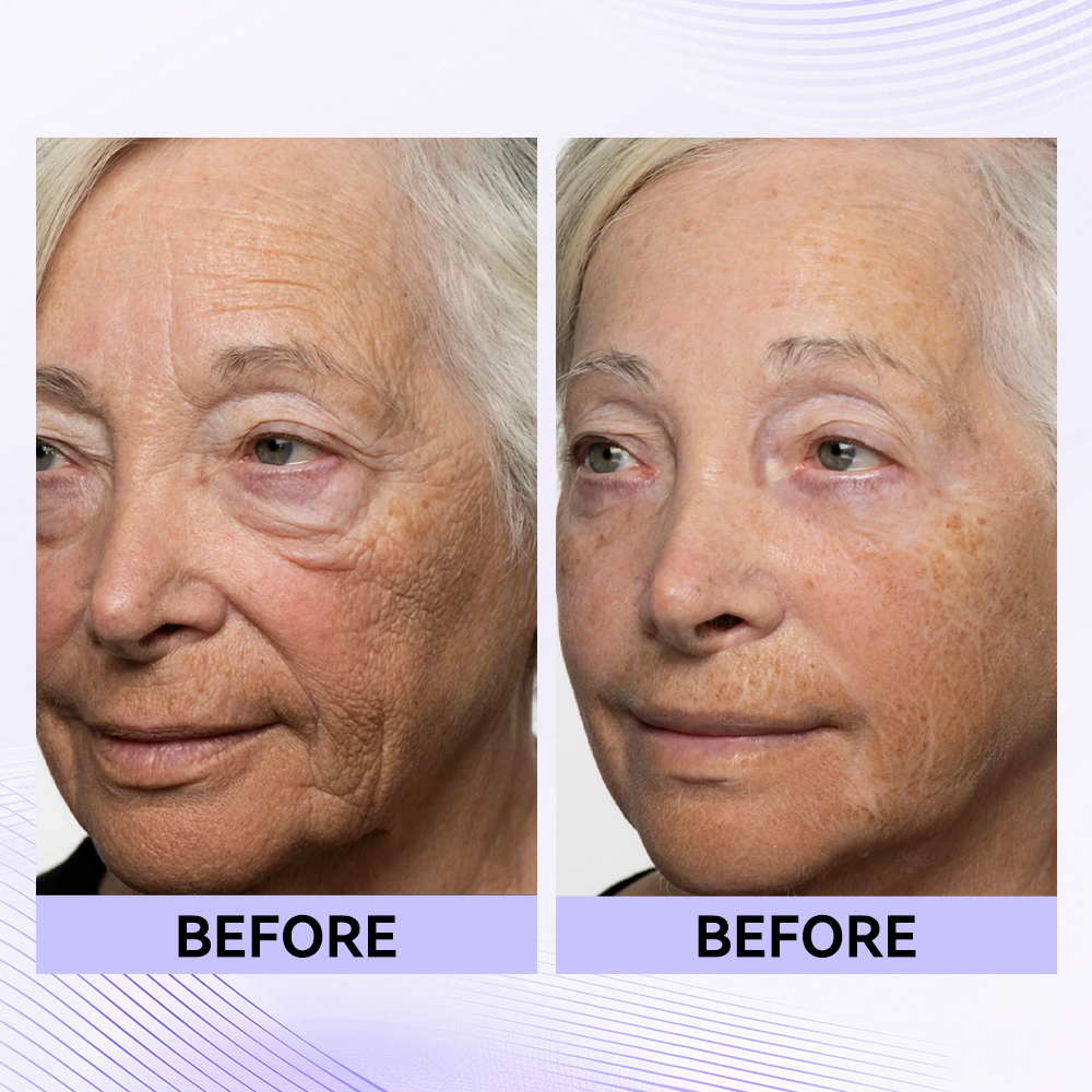 Last 3 Hours:🔥 Up to 60% OFF – Instant Eye Tightener Easy-Wear Formula