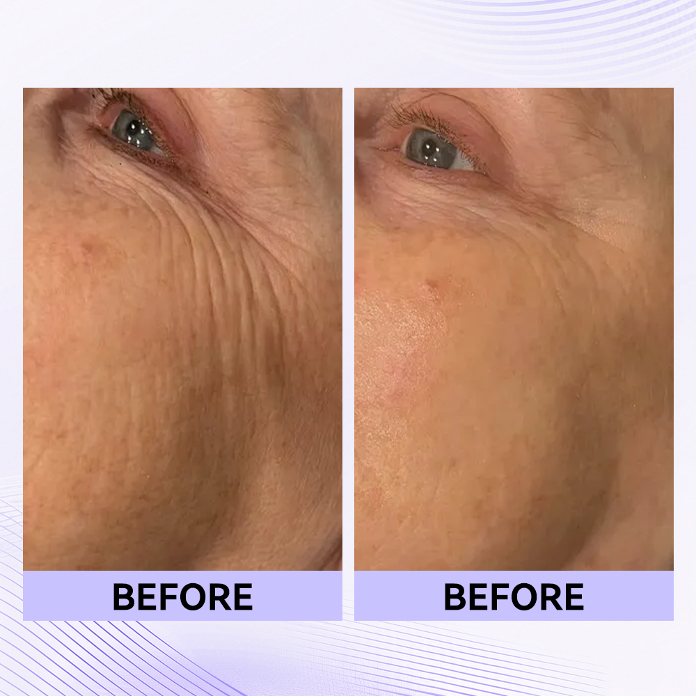 Last 3 Hours:🔥 Up to 60% OFF – Instant Eye Tightener Easy-Wear Formula