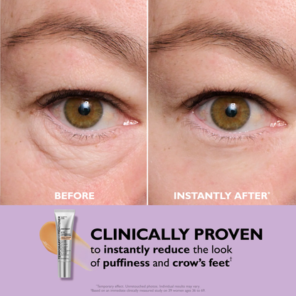 Last 3 Hours:🔥 Up to 60% OFF – Instant Eye Tightener Easy-Wear Formula
