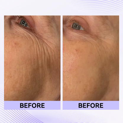 Last 3 Hours:🔥 Up to 60% OFF – Instant Eye Tightener Easy-Wear Formula